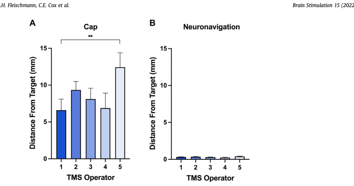 La neuronavigation pour TMS permet un positionnement exact quel que soit l'opérateur